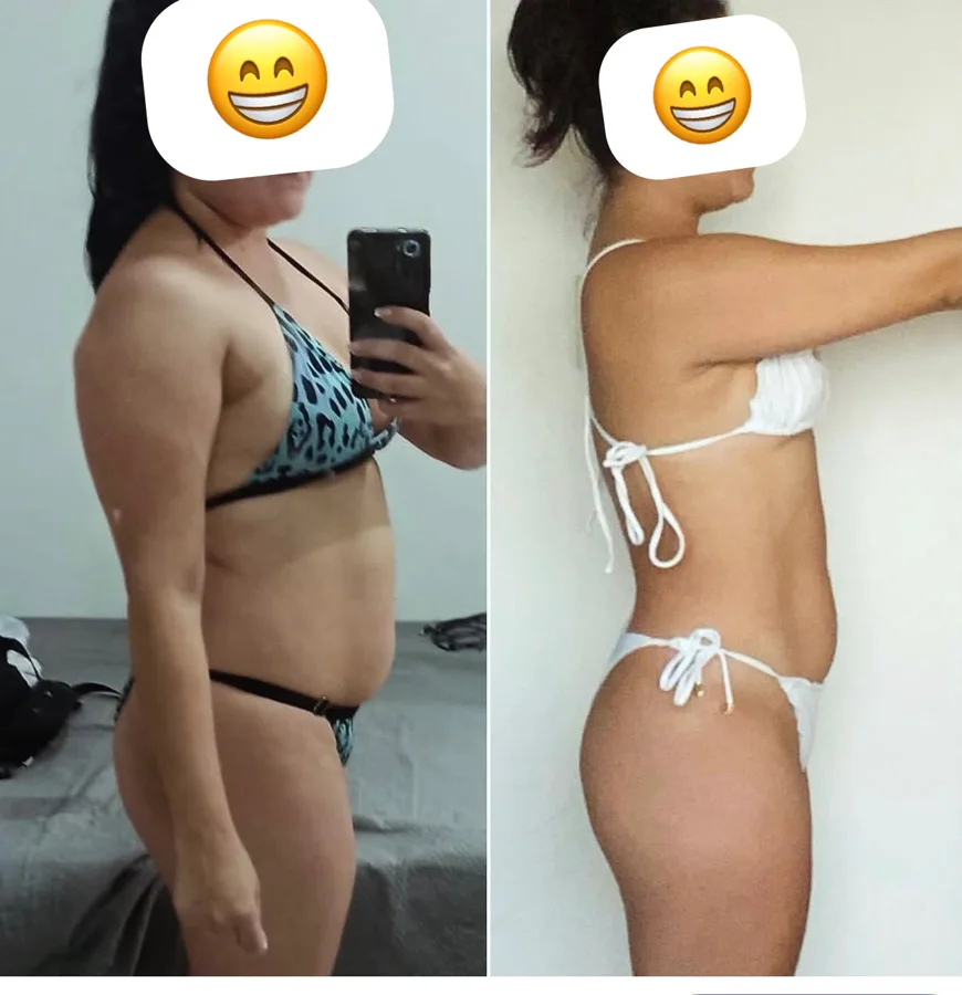 Aluna antes e depois do acompanhamento, vista de lado